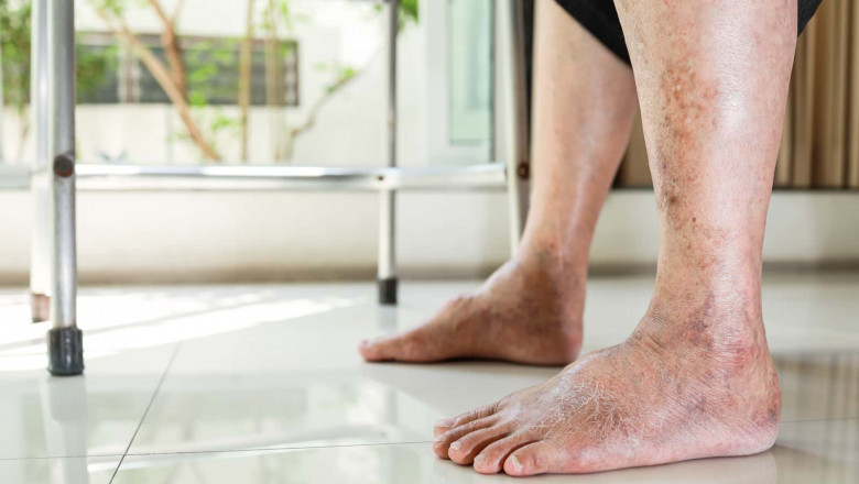 The Best Shoes for Diabetic Feet: Comfort, Support, and Protection