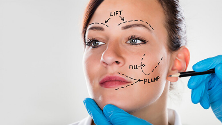 Facelift surgery cost in Delhi - Dr Rajat Gupta