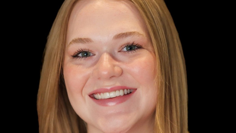 Teeth Whitening in Savannah