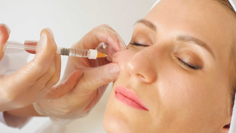 Customizing Cheek Fillers for Your Face Shape