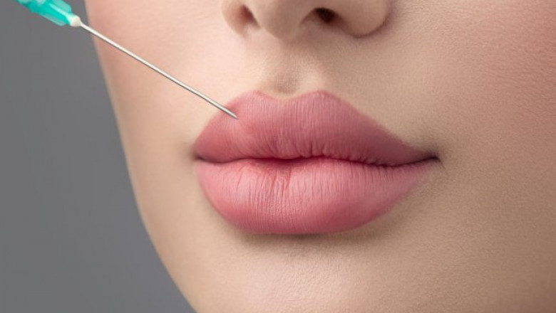 The Importance of Aftercare for Russian Lip Fillers in Dubai