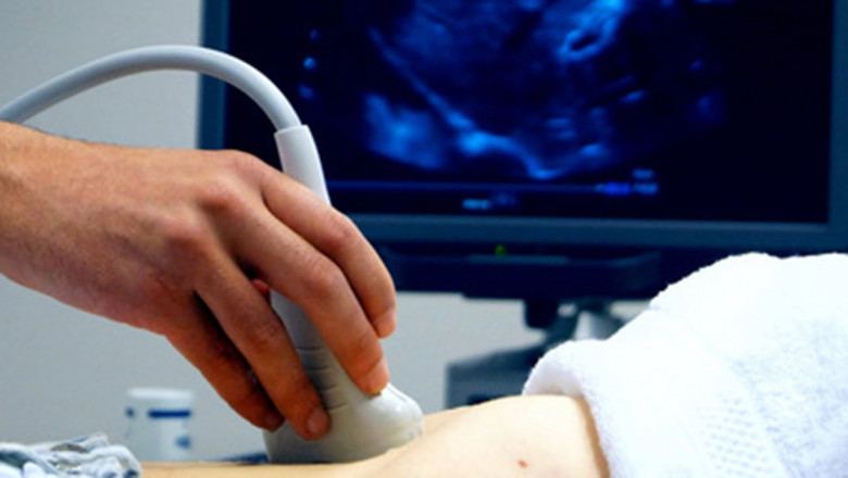 Doppler Ultrasound: A Non-Invasive Diagnostic Tool for Assessing Blood Flow