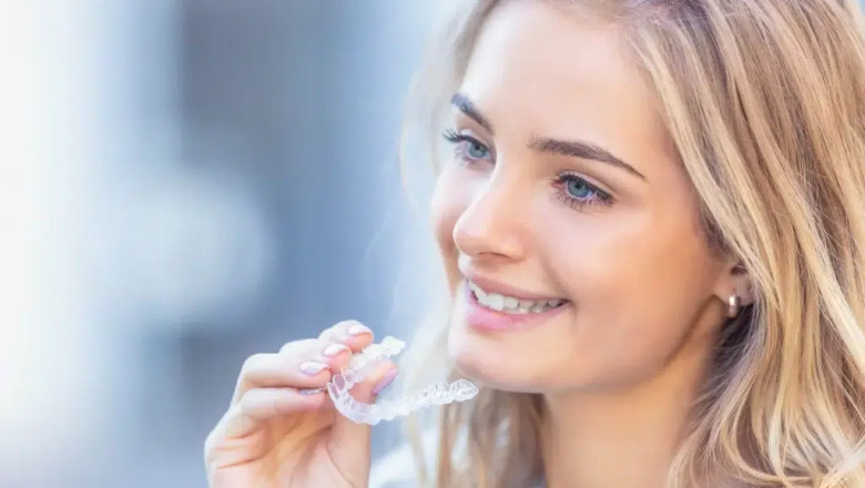 Transform Your Smile with Composite Bonding in Brisbane