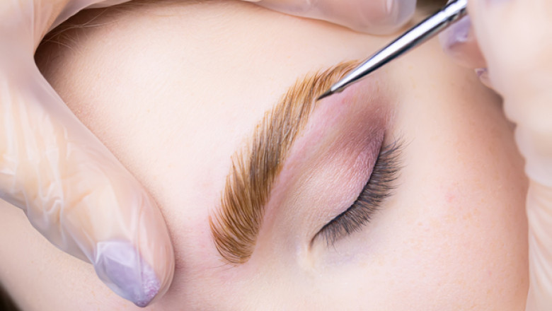 Young Professionals in Dubai Are Opting for Eyebrow Transplants – Here’s Why