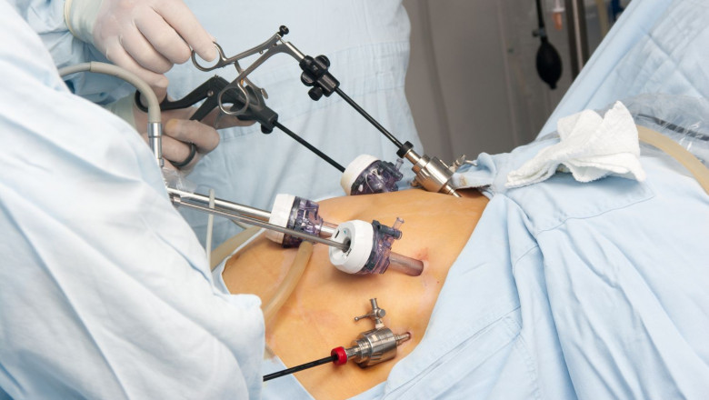 Bariatric Surgery and Nutrition Must-Knows