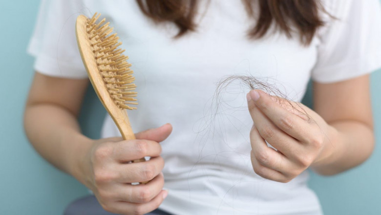 Hair Loss Treatment: What to Avoid for Better Results