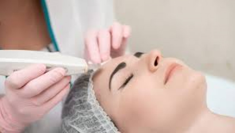 Hydrafacial for Brides, Is It Recommended?