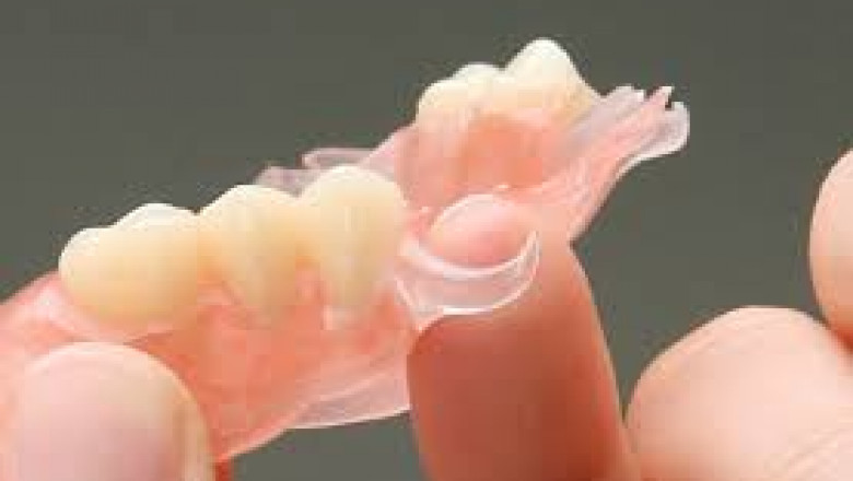 Removable Partial Denture Market to Grow with Digital Dentistry