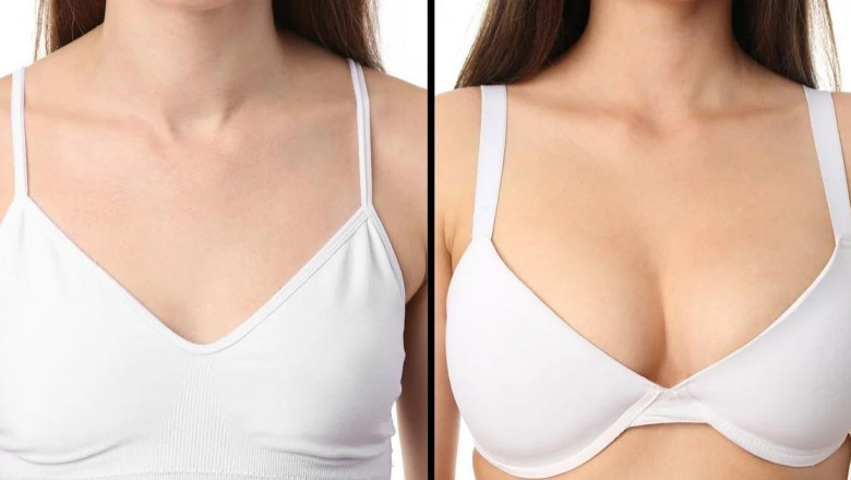Best Breast Augmentation Surgeons in Dubai Discuss the Latest Trends in Cosmetic Surgery