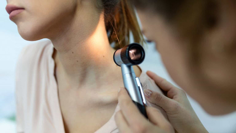 Best Dermatologist Tips on Managing Oily and Acne-Prone Skin