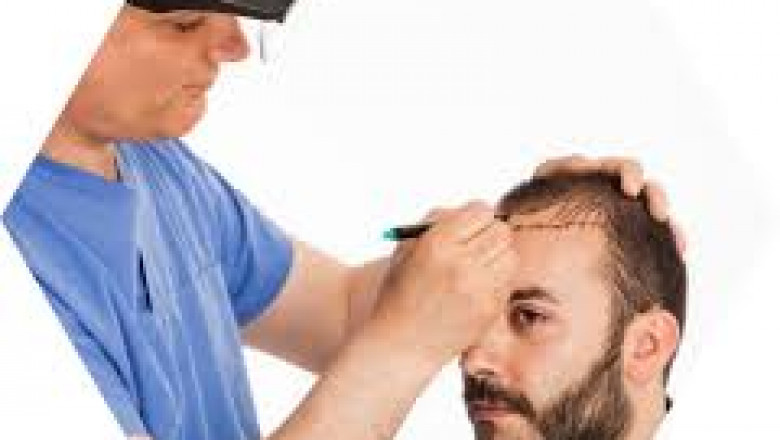 Revive Your Confidence: Best Hair Transplant in Gurgaon & Noida with Cost Breakdown and Expert Care