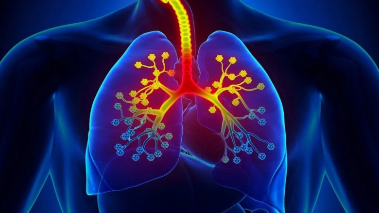 Best Asthma Doctors in Durgakund: Trusted Specialists for Long-Term Respiratory Care
