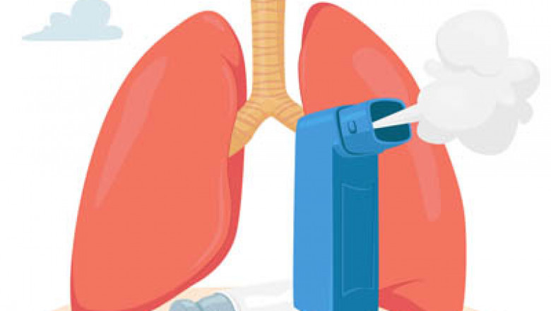Best COPD Doctors in Varanasi: Expert Care for Chronic Obstructive Pulmonary Disease