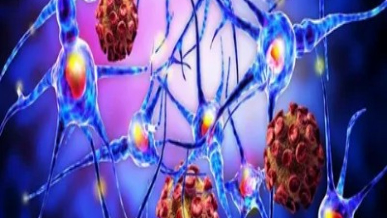 Metastatic Melanoma Therapeutics Market to Surge on Immunotherapy Advancements