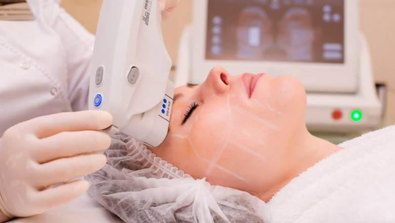 HIFU Treatment in Islamabad: Sector-by-Sector Comparison