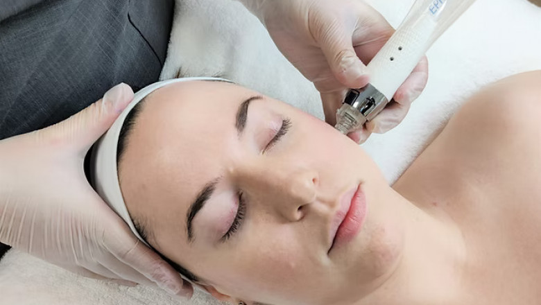 Can You Do Head Spa, Microneedling, and Ultherapy in One Session?