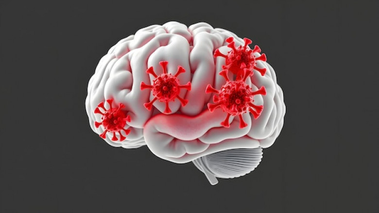 Clinical Advances in Tuberculous Meningitis: Transforming Patient Outcomes Through Innovation