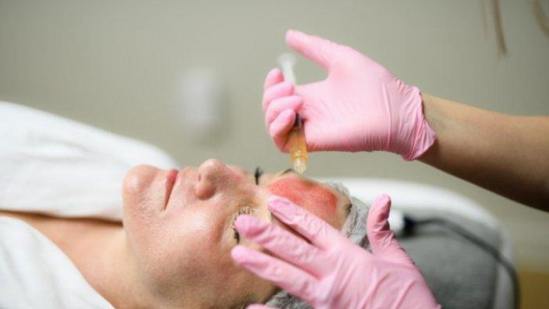 What Results Can You Expect From Your First Vampire Facial?