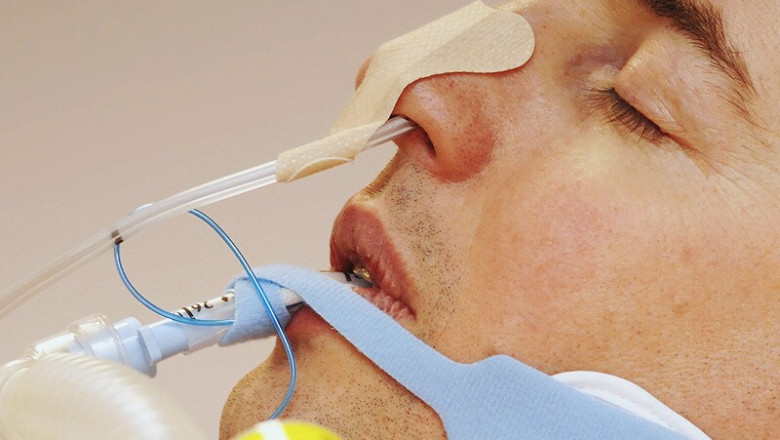 Global Feeding Tubes Market Will Grow Fastest Owing to Home Care Demand