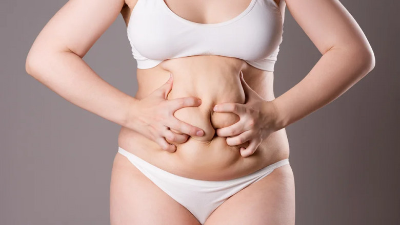 Before and After Liposuction: What Real Patients Say