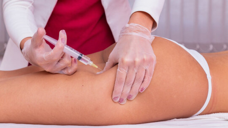 Body Fillers in Islamabad: Before & After Results That Speak Volumes