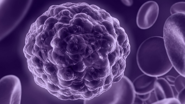 Advancements in Leukemia Therapeutics: Promising Treatment Options for Blood Cancer Patients