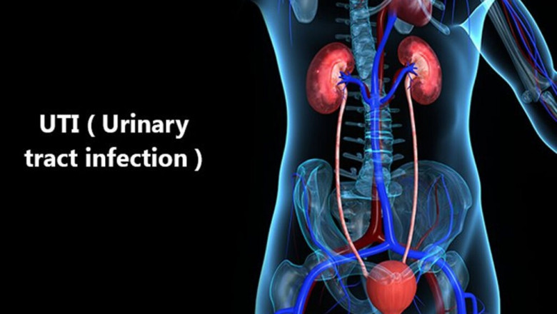 Urinary Tract Infection Therapeutic Market Anticipated to Surge on Novel Antibiotics