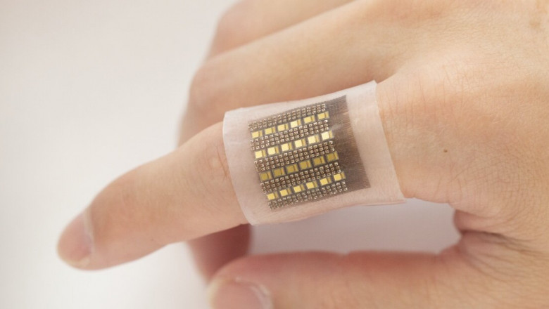 Wearable Patch Market is growing amid Strategic Health Investment