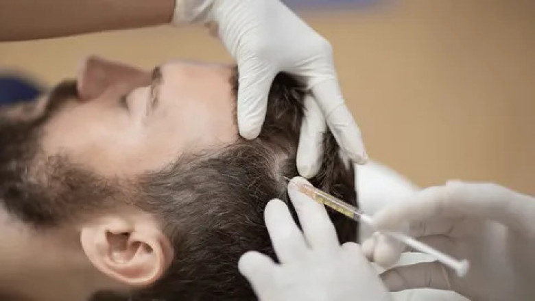 Hair Loss Treatment Market Sees Surge Amid Regulatory Reforms
