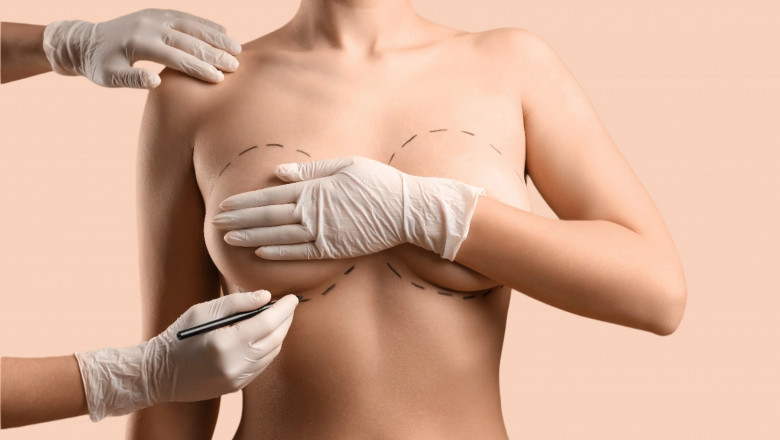 Combining Breast Augmentation in Dubai with Other Cosmetic Procedures for a Complete Transformation