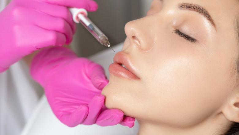 Filling Depressed Scars or Indentations on the Face: A Complete Guide to Dermal Fillers in Islamabad