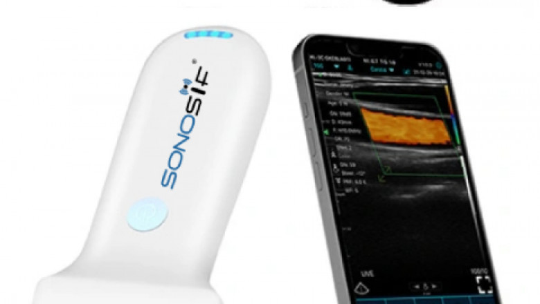 SONOSIF - Advanced Ultrasound Scanners & Medical Devices