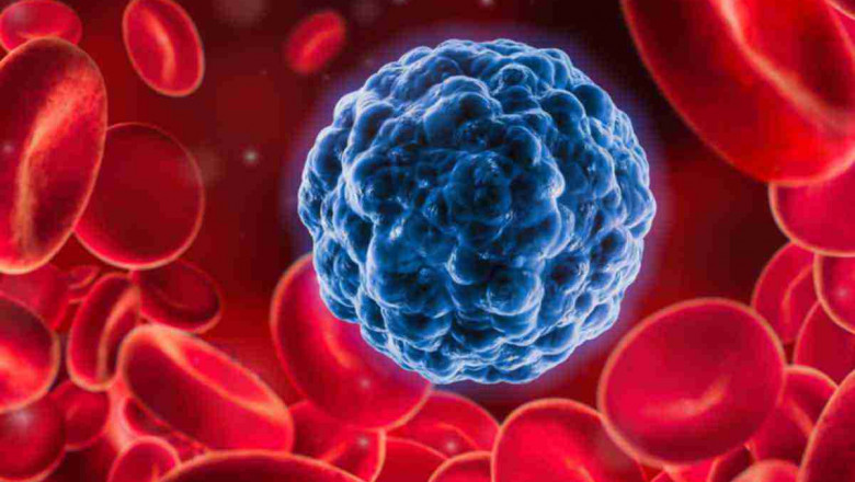 Leukemia Therapeutics: Promising Treatment Options for Blood Cancer Patients