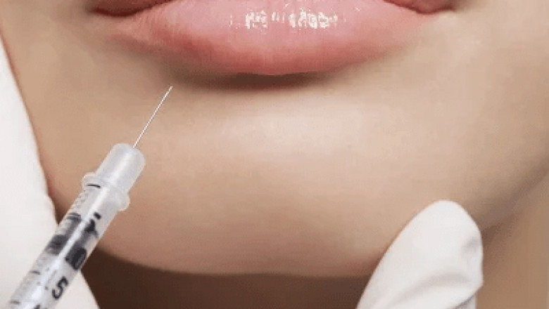What Age Is Ideal to Start Getting Fillers?