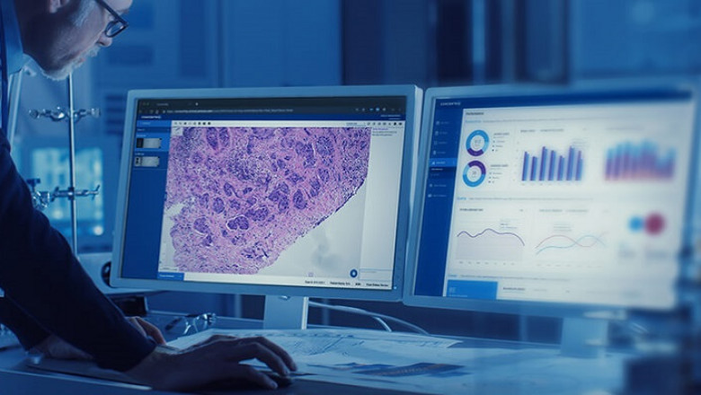 AI-based Digital Pathology Market Size, Trends, and Growth Strategies Analysis
