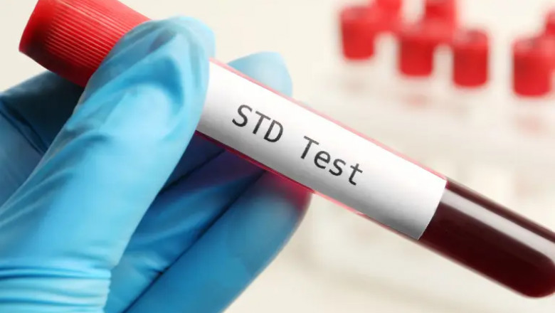 Essential STD Testing Information Dubai Residents Must Know in 2025