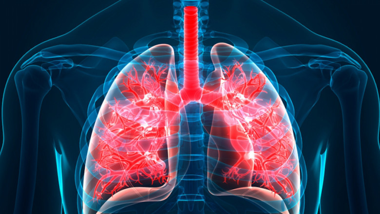 Idiopathic Pulmonary Fibrosis Market Size, Trends, and Strategic Outlook 2025-2032