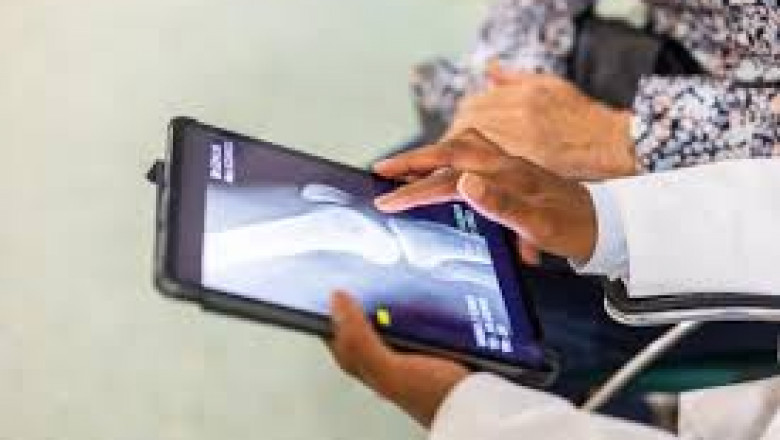 Electronic Health Records Market Size, Trends, and Growth Analysis 2025-2032