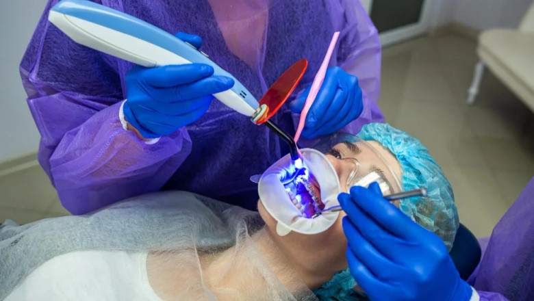 How to Care for Your Teeth After a Permanent Filling