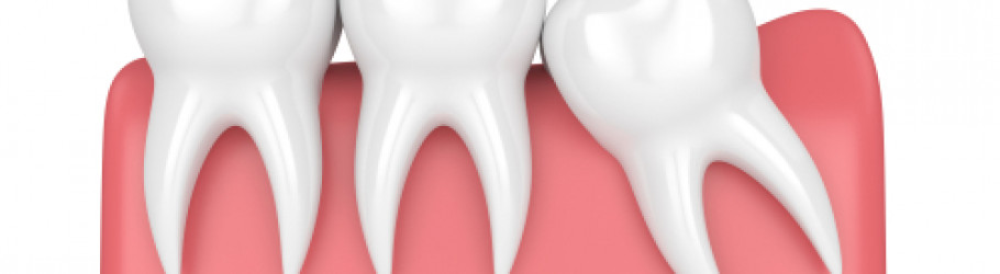 wisdomteethvic
