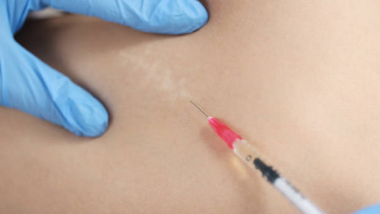 Fat melting injection in Dubai