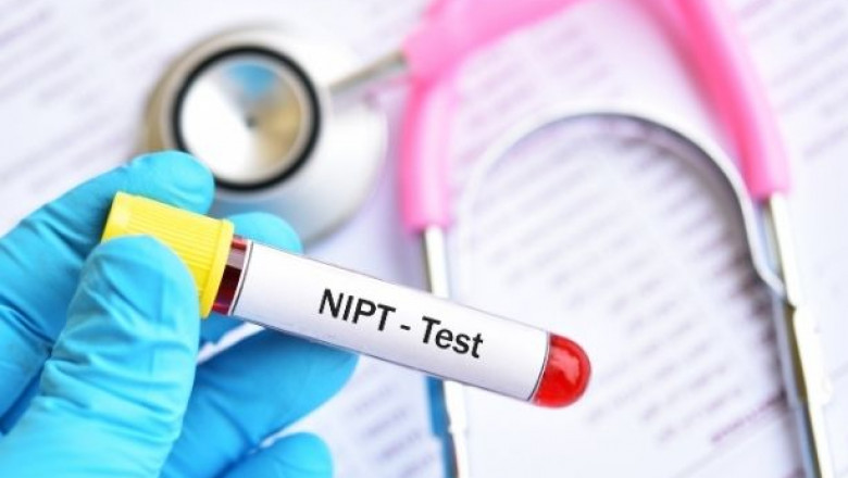Get a Hassle-Free NIPT Test at Home with Expert Care