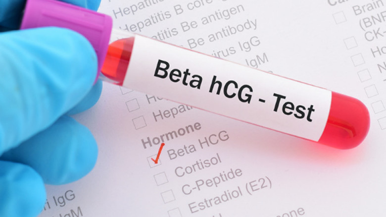 Everything You Need to Know About the Beta HCG Test in Dubai