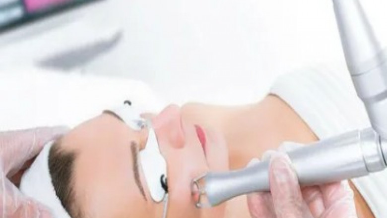 Medical Laser Systems Market is Estimated to Witness High Growth Owing to Advancements in Laser Technology