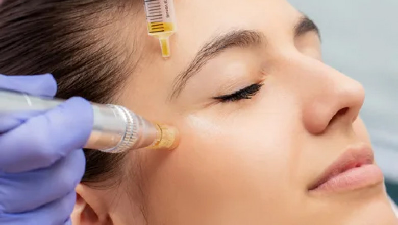 Searching for Microneedling Treatment Near Me? Here’s Why Revitalize Medi-Spa is Your Best Choice