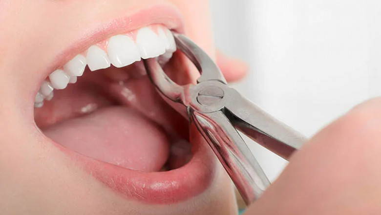 Emergency Dental Services in McKinney, TX: Fast Relief When You Need It Most