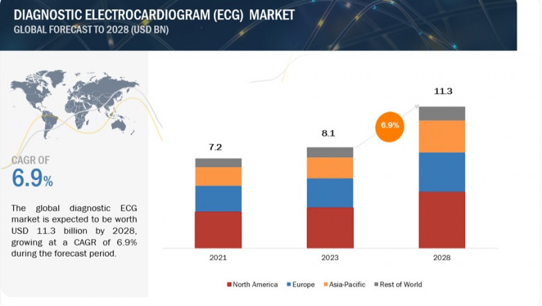 The Evolution of Diagnostic Electrocardiograph (ECG) Industry: Opportunities, Trends, and Global Outlook
