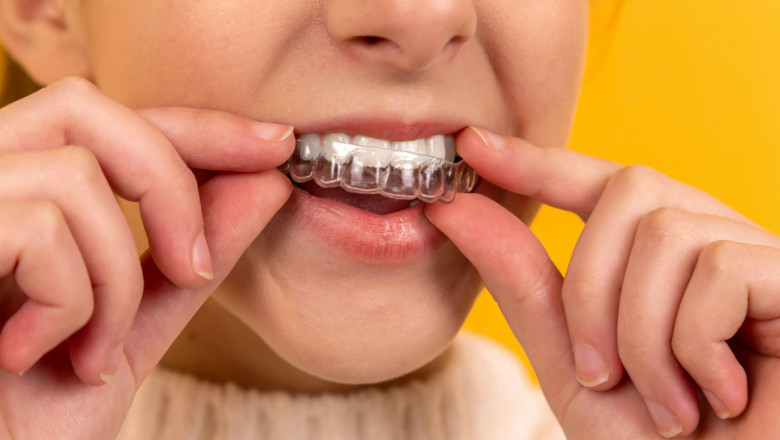 Restore Your Smile with Dental Implants in Brisbane