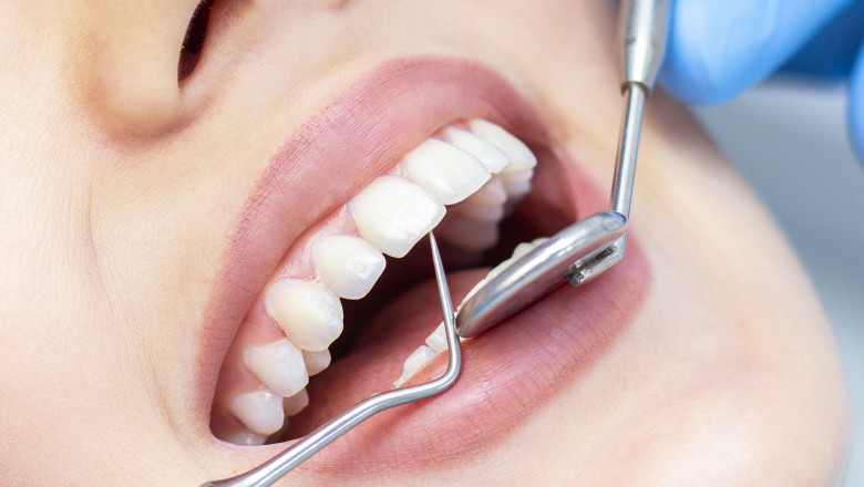 What Is the Role of a General Dentist in Oral Health?