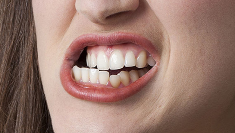 What Are the Latest Treatments for Teeth Grinding?